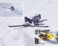 ZOH26 Lyžovanie: Lindsey Vonnová po desivom páde skončila na operačnom stole